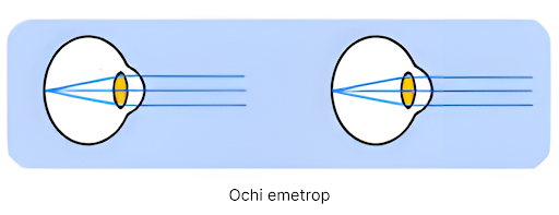 Ochi emetrop – focalizare la infinit